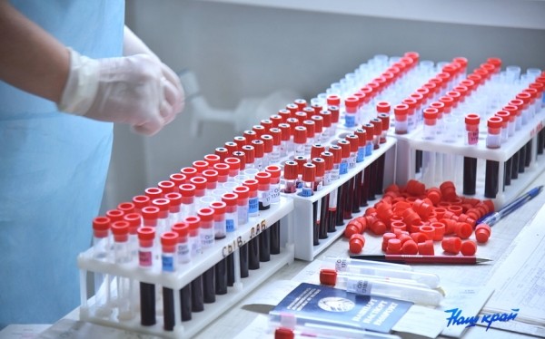 Сколько новых случаев заражения ВИЧ выявлено в Барановичском регионе с начала года