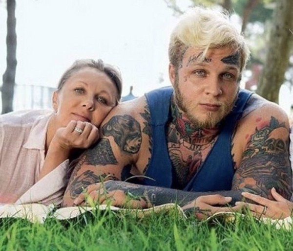 Как выглядит лицо после удаления татуировки Как выглядит лицо после удаления татуировки