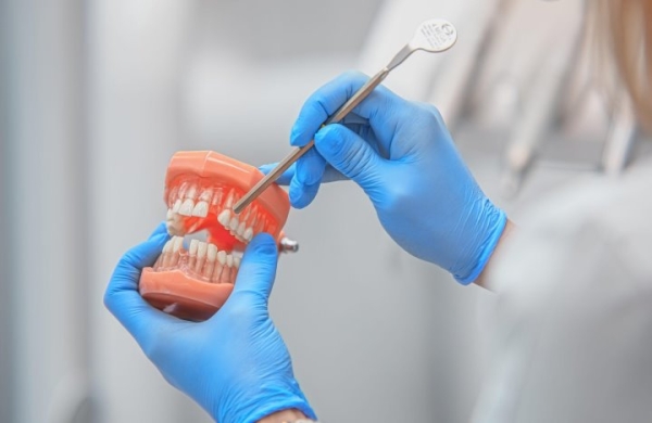 «Потратил $8 тысяч на зубы». Узнали, во сколько белорусам обходятся стоматологические услуги «Потратил $8 тысяч на зубы». Узнали, во сколько белорусам обходятся стоматологические услуги