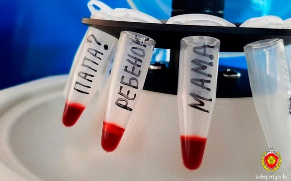 В Барановичском районе отец пятерых детей заказал экспертизу ДНК и был шокирован